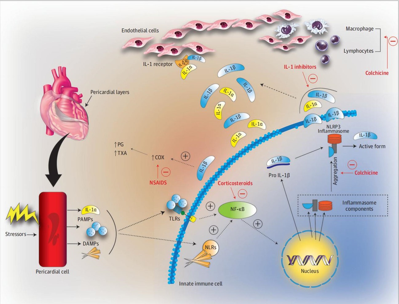 要點總結，復發性心包炎的影像學和靶向治療進展 | 高分綜述