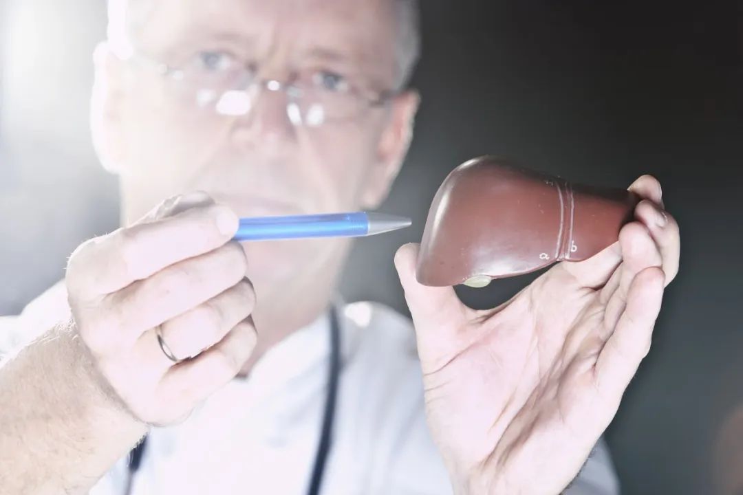 肝癌死亡率“悄悄”增加，原因竟然不是乙肝病毒！