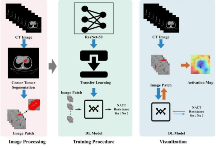 Gastric Cancer：深度學(xué)習(xí)模型預(yù)測進展期胃癌新輔助化療療效