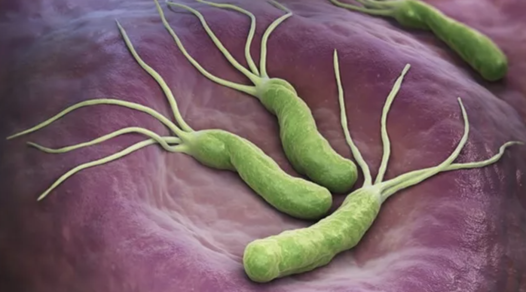 是時候根除一下了！頂刊發(fā)文：根除幽門螺旋桿菌可使胃癌風(fēng)險降低50%！