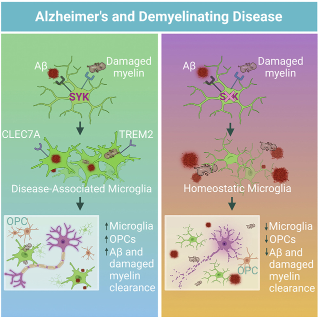 2022年終盤點：阿爾茲海默病研究領域重磅級成果！