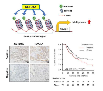 Cancer Sci：科學家識別出抵御人類胰腺癌的關鍵分子靶點